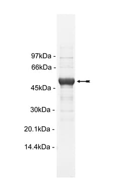 Eurofins DiscoverX Fms Protein, Active 10 &mu;g | Buy Online | Eurofins DiscoverX | Fisher Scientific
